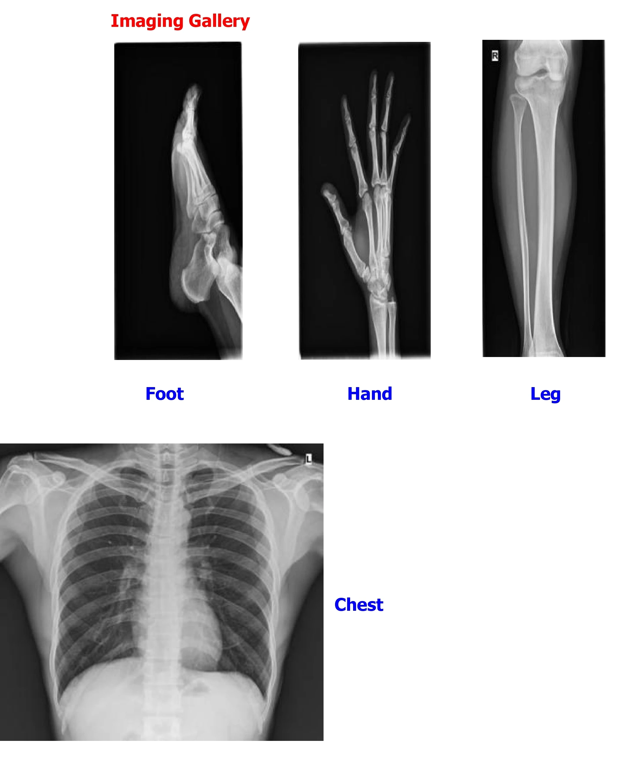 Équipement de radiographie mob - X Medical Lab avis et prix